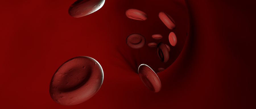造血干细胞移植治疗多发性硬化