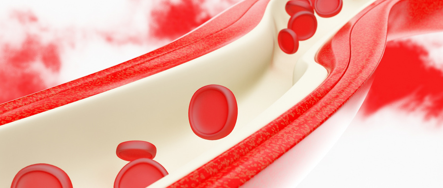 自体造血干细胞移植是淋巴瘤的治疗选择