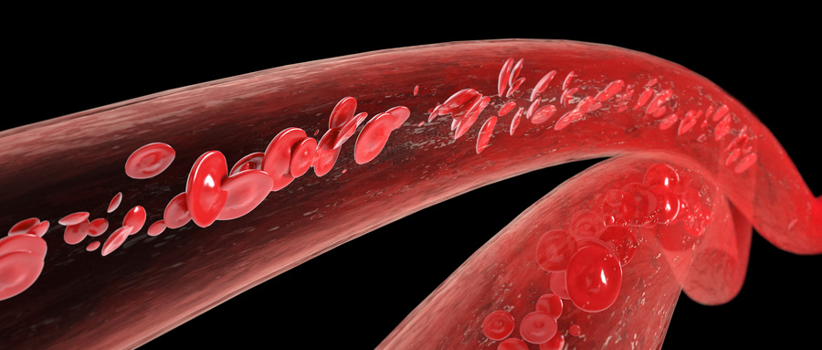 问：造血干细胞移植患者的生活质量有什么影响？